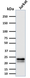 Anti-CD3 epsilon antibody [C3e/2478] used in Western Blot (WB). GTX17864