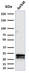 Anti-CD3 epsilon antibody [C3e/2479] used in Western Blot (WB). GTX17865