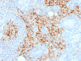 Anti-CD14 antibody [LPSR/2385] used in IHC (Paraffin sections) (IHC-P). GTX17867
