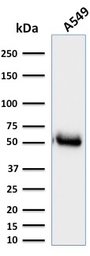 Anti-CD14 antibody [LPSR/2385] used in Western Blot (WB). GTX17867