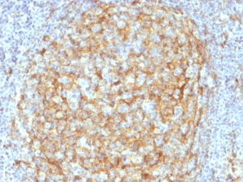 Anti-CD14 antibody [LPSR/2386] used in IHC (Paraffin sections) (IHC-P). GTX17873