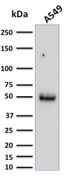Anti-CD14 antibody [LPSR/2386] used in Western Blot (WB). GTX17873