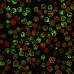 Anti-CD79a antibody [rIGA/764] used in Immunocytochemistry/ Immunofluorescence (ICC/IF). GTX17887