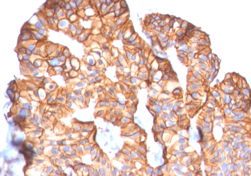 Anti-Her2 / ErbB2 antibody [ERBB2/2452] used in IHC (Paraffin sections) (IHC-P). GTX17891