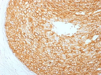 Anti-Her2 / ErbB2 antibody [ERBB2/2453] used in IHC (Paraffin sections) (IHC-P). GTX17894
