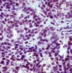 Anti-Thyroid Hormone Receptor beta antibody [SPM222] used in IHC (Paraffin sections) (IHC-P). GTX17898