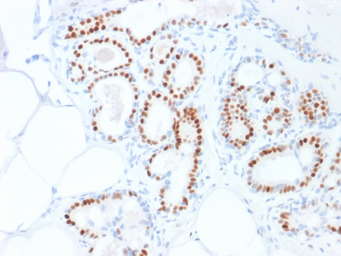 Anti-Estrogen Receptor alpha antibody [ESR1/1935] used in IHC (Paraffin sections) (IHC-P). GTX17904