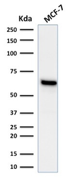 Anti-Estrogen Receptor alpha antibody [ESR1/1935] used in Western Blot (WB). GTX17904