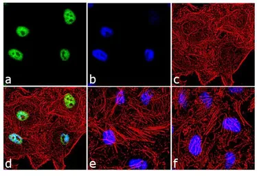 Anti-c-Fos (phospho Thr232) antibody used in Immunocytochemistry/ Immunofluorescence (ICC/IF). GTX17933