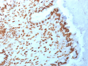 Anti-TLE1 antibody [TLE1/2062] used in IHC (Paraffin sections) (IHC-P). GTX17936