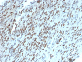 Anti-TLE1 antibody [TLE1/2062] used in IHC (Paraffin sections) (IHC-P). GTX17936