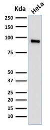Anti-TLE1 antibody [TLE1/2062] used in Western Blot (WB). GTX17936