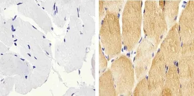 Anti-HSP27 (phospho Ser82) antibody used in IHC (Paraffin sections) (IHC-P). GTX17937