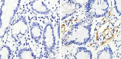 Anti-HSP27 (phospho Ser82) antibody used in IHC (Paraffin sections) (IHC-P). GTX17937
