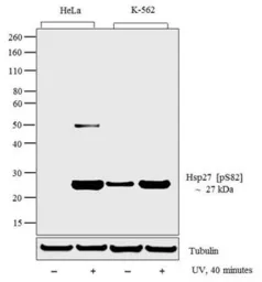 Anti-HSP27 (phospho Ser82) antibody used in Western Blot (WB). GTX17937