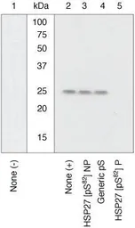 Anti-HSP27 (phospho Ser82) antibody used in Western Blot (WB). GTX17937
