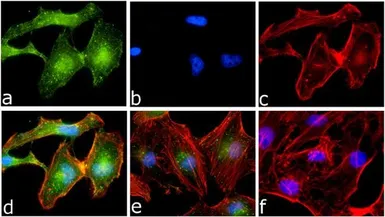 Anti-IKK alpha (phospho Ser176/Ser180) antibody used in Immunocytochemistry/ Immunofluorescence (ICC/IF). GTX17943