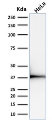 Anti-Emerin antibody [EMD/2168] used in Western Blot (WB). GTX17952