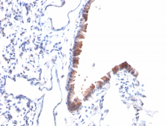 Anti-Mesothelin antibody [MSLN/2131] used in IHC (Paraffin sections) (IHC-P). GTX17953