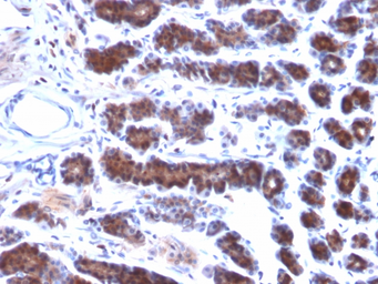 Anti-Mesothelin antibody [MSLN/2131] used in IHC (Paraffin sections) (IHC-P). GTX17953