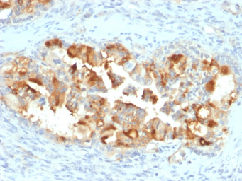 Anti-Mesothelin antibody [MSLN/2131] used in IHC (Paraffin sections) (IHC-P). GTX17953