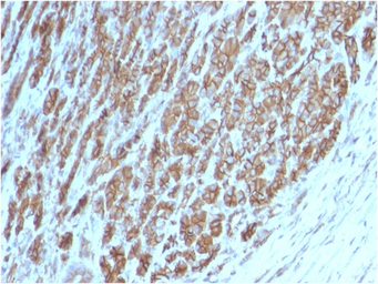 Anti-beta Catenin antibody [CTNNB1/2098] used in IHC (Paraffin sections) (IHC-P). GTX17954