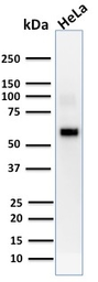 Anti-AKT1 antibody [AKT1/2552] used in Western Blot (WB). GTX17956