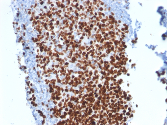 Anti-Ki67 antibody [MKI67/2462] used in IHC (Paraffin sections) (IHC-P). GTX17971