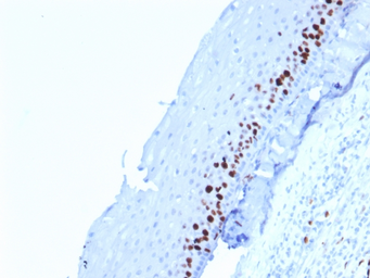 Anti-Ki67 antibody [MKI67/2462] used in IHC (Paraffin sections) (IHC-P). GTX17971