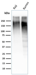 Anti-Ki67 antibody [MKI67/2462] used in Western Blot (WB). GTX17971