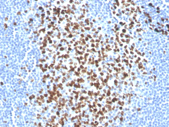 Anti-Ki67 antibody [MKI67/2465] used in IHC (Paraffin sections) (IHC-P). GTX17972