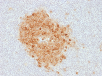 Anti-CD10 antibody [MME/1893] used in IHC (Paraffin sections) (IHC-P). GTX17974