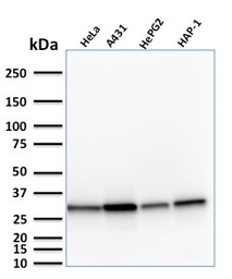 Anti-MTAP antibody [MTAP/1813] used in Western Blot (WB). GTX17975