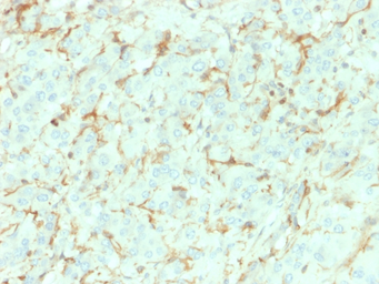 Anti-p75 NGF Receptor / CD271 antibody [NGFR/1964] used in IHC (Paraffin sections) (IHC-P). GTX17979