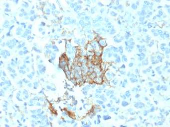 Anti-p75 NGF Receptor / CD271 antibody [NGFR/1964] used in IHC (Paraffin sections) (IHC-P). GTX17979