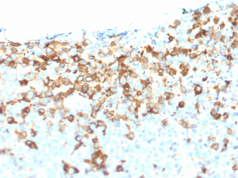 Anti-p75 NGF Receptor / CD271 antibody [NGFR/1964] used in IHC (Paraffin sections) (IHC-P). GTX17979