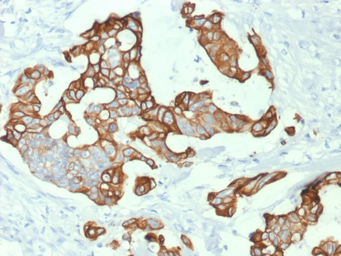 Anti-Cytokeratin 20 antibody [KRT20/1992] used in IHC (Paraffin sections) (IHC-P). GTX17981