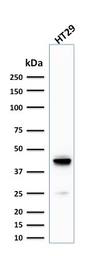 Anti-Cytokeratin 20 antibody [KRT20/1992] used in Western Blot (WB). GTX17981