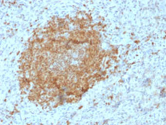Anti-BOB1 antibody [BOB1/2425] used in IHC (Paraffin sections) (IHC-P). GTX17983
