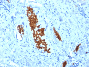 Anti-alpha 1 Spectrin antibody [SPTA1/1810] used in IHC (Paraffin sections) (IHC-P). GTX17998