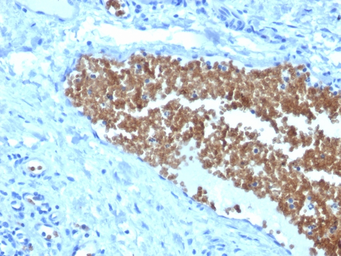 Anti-alpha 1 Spectrin antibody [SPTA1/1832] used in IHC (Paraffin sections) (IHC-P). GTX18000