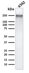 Anti-alpha 1 Spectrin antibody [SPTA1/1832] used in Western Blot (WB). GTX18000