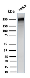 Anti-alpha 1 Spectrin antibody [SPTA1/1832] used in Western Blot (WB). GTX18000