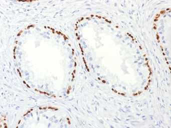 Anti-p63 antibody [TP63/2427] used in IHC (Paraffin sections) (IHC-P). GTX18022