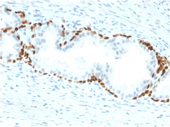 Anti-p63 antibody [TP63/2428] used in IHC (Paraffin sections) (IHC-P). GTX18023