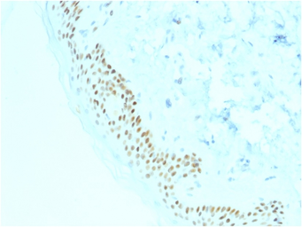 Anti-p63 antibody [TP63/2428] used in IHC (Paraffin sections) (IHC-P). GTX18023