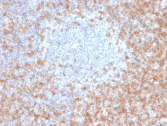 Anti-CD5 antibody [CD5/2416] used in IHC (Paraffin sections) (IHC-P). GTX18024