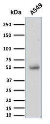 Anti-CD14 antibody [LPSR/2397] used in Western Blot (WB). GTX18025