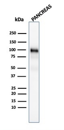 Anti-GP2 antibody [GP2/1805] used in Western Blot (WB). GTX18034