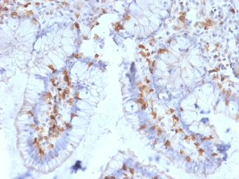 Anti-Integrin alpha E antibody [ITGAE/2063] used in IHC (Paraffin sections) (IHC-P). GTX18035